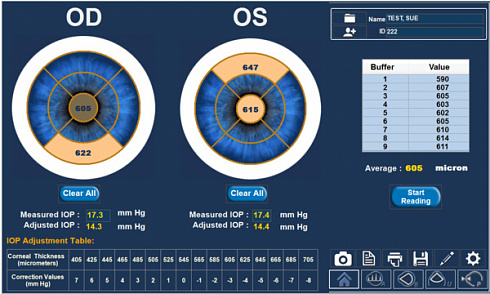 Ультразвуковая офтальмологическая система диагностики 4Sight: A scan, B scan, пахиметрия 